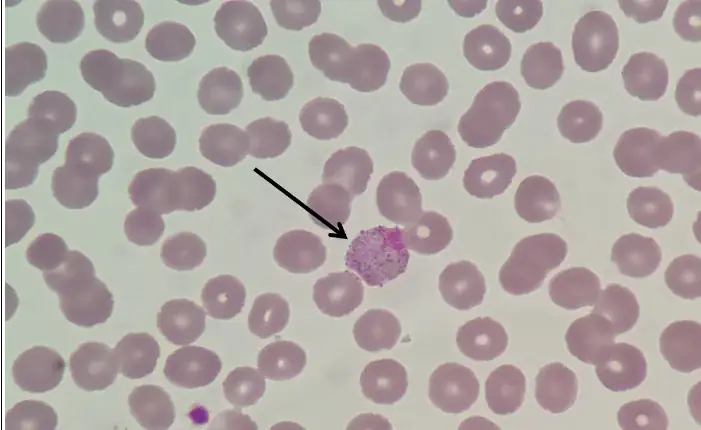 疟原虫配子体
