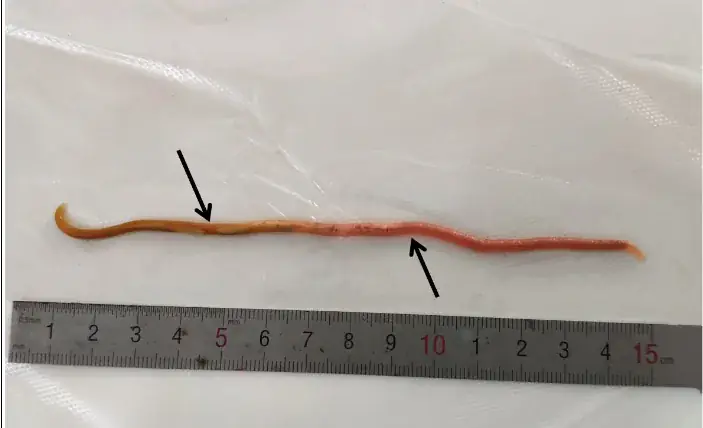蛔虫成虫